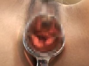 【盗撮動画】産婦人科でクスコを突っ込まれた人妻、濡れた腟内で愛液が糸を引く様子を観察されてしまう